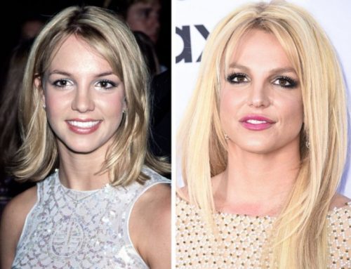 Top 10 Celebs Who Did Plastic Surgery - Britney Spears
